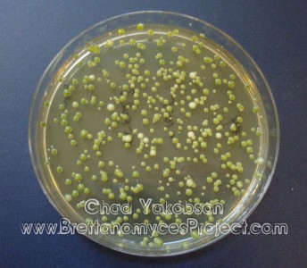 WLN agar green and white yeast colonies